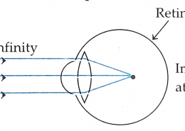 Study the diagram given below and answer the questions: (i) Name the defect of vision represented in the diagram. (ii) Redraw the diagram and show how a corrective lens resolves this defect? Label the lens type and focal point.