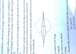Renuka was studying a diagram related to a defect of vision and noted down possible causes for it. She wrote the following statements in her notebook. I. The focal length of the eye lens is too long. II. The eye ball becomes too small. III. The focal length of the eye lens is too short. IV. The eye ball becomes too long. Based on the given diagram, choose to the correct option that lists the correct causes of this defect.